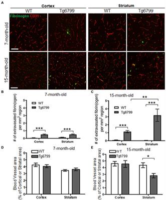 Striatal fibrinogen extravasation and vascular degeneration correlate with motor dysfunction in an aging mouse model of Alzheimer’s disease